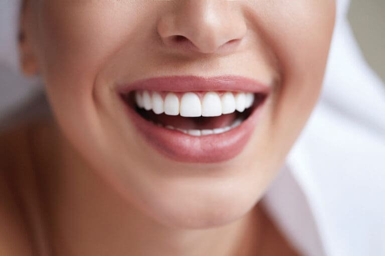 Healthy White Smile Close Up. Beauty Woman With Perfect Smile, Lips And Teeth. Beautiful Model Girl With Perfect Skin. Teeth Whitening.