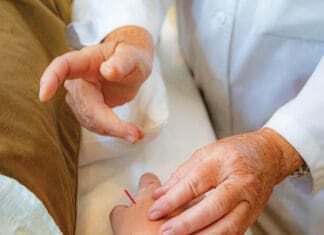 Debunking the Top 5 Misconceptions About Acupuncture Tortoise Clinic Acupuncture 1